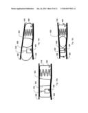 IMPACT REDUCTION SYSTEM diagram and image