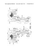 Woven Planar Footwear Upper diagram and image