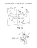 Woven Planar Footwear Upper diagram and image