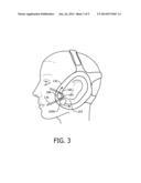 PATIENT INTERFACE ASSEMBLY WITH SELF-ADJUSTING ANCHOR POINTS diagram and image