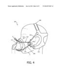 PATIENT INTERFACE ASSEMBLY WITH SELF-ADJUSTING ANCHOR POINTS diagram and image