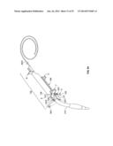 EVERTING DEVICE AND METHOD FOR TRACHEOSTOMY diagram and image