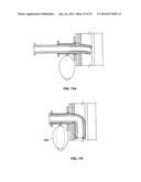 EVERTING DEVICE AND METHOD FOR TRACHEOSTOMY diagram and image