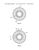 EVERTING DEVICE AND METHOD FOR TRACHEOSTOMY diagram and image