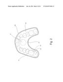 Mouthguard Magnetic Retention System diagram and image