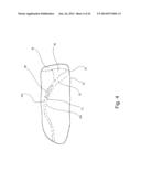 Mouthguard Magnetic Retention System diagram and image