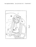 Mouthguard Magnetic Retention System diagram and image