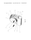 Mouthguard Magnetic Retention System diagram and image