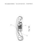 Mouthguard Magnetic Retention System diagram and image