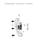 Mouthguard Magnetic Retention System diagram and image