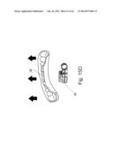 Mouthguard Magnetic Retention System diagram and image