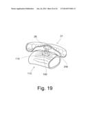 Mouthguard Magnetic Retention System diagram and image