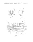 Method And Arrangement For Vortex Reduction In A Metal Making Process diagram and image