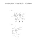 PEDESTRIAN PROTECTIVE RADIATOR GRILL diagram and image