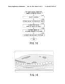 IMAGE DIAGNOSIS DEVICE AND CONTROL METHOD THEREOF diagram and image