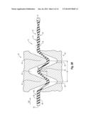 INCREMENTALLY-STRETCHED THERMOPLASTIC FILMS WITH ENHANCED LOOK AND FEEL     AND METHODS FOR MAKING THE SAME diagram and image