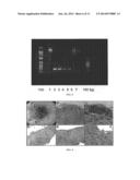 MINIMALLY-INVASIVE MEASUREMENT OF ESOPHAGEAL INFLAMMATION diagram and image