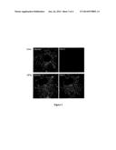 SCREENING METHODS BASED ON VESICLE MOBILITY diagram and image