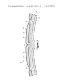 Sport Ball With Indented Casing diagram and image