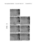 COMPOSITION FOR REDUCING SKIN WRINKLES INCLUDING PDE5 INHIBITOR diagram and image