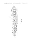 SYSTEMS AND METHODS FOR IMPROVING CARDIAC FUNCTION diagram and image