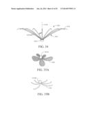 SYSTEMS AND METHODS FOR IMPROVING CARDIAC FUNCTION diagram and image