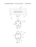 MEANS FOR SECURING A CATHETER INTO A VESSEL diagram and image