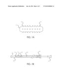 FIDUCIARY MARKERS AND METHODS OF PLACEMENT diagram and image