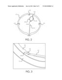 FIDUCIARY MARKERS AND METHODS OF PLACEMENT diagram and image