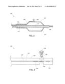 CATHETER WITH BALLOON AND IMAGING diagram and image