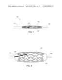 CATHETER WITH BALLOON AND IMAGING diagram and image