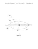 CATHETER WITH BALLOON AND IMAGING diagram and image