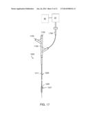 CATHETER WITH BALLOON AND IMAGING diagram and image