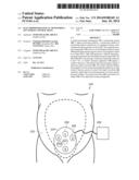 ELECTROPHYSIOLOGICAL MONITORING OF UTERINE CONTRACTIONS diagram and image