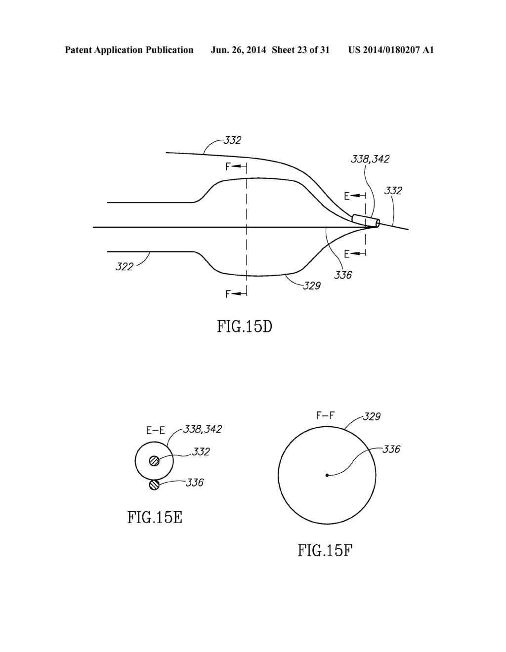 VARIABLE LENGTH CATHETER FOR DRUG DELIVERY - diagram, schematic, and image 24