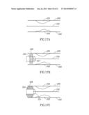 VARIABLE LENGTH CATHETER FOR DRUG DELIVERY diagram and image