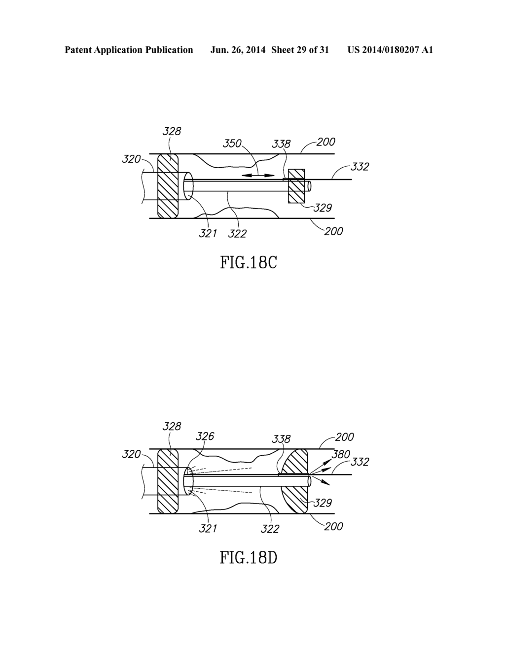 VARIABLE LENGTH CATHETER FOR DRUG DELIVERY - diagram, schematic, and image 30