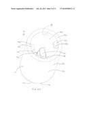 NEEDLE TIP PROTECTOR ASSEMBLY FOR SAFETY IV CATHETER ASSEMBLY diagram and image