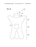 BODY ADHERING ABSORBENT ARTICLE diagram and image