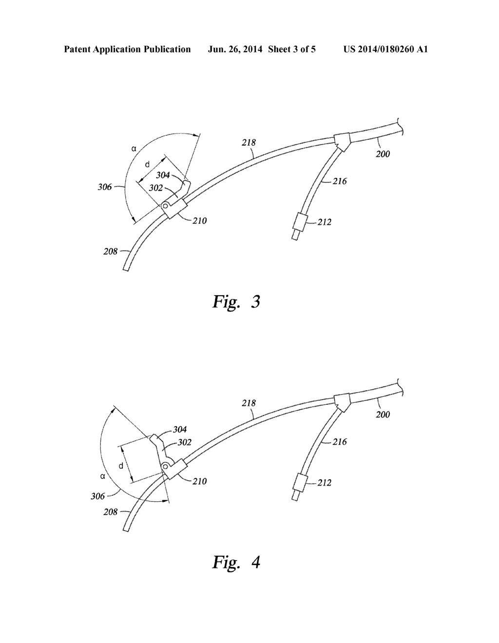 METHODS RELATED TO A BAGLESS CATHETER - diagram, schematic, and image 04