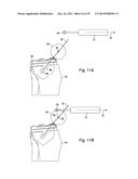 SYSTEMS  AND METHODS FOR HAPTIC CONTROL OF A SURGICAL TOOL diagram and image