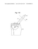 SYSTEMS  AND METHODS FOR HAPTIC CONTROL OF A SURGICAL TOOL diagram and image