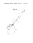 SYSTEMS  AND METHODS FOR HAPTIC CONTROL OF A SURGICAL TOOL diagram and image