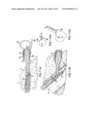 ARTICULATING SUTURING DEVICE AND METHOD diagram and image