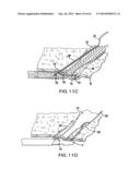 ARTICULATING SUTURING DEVICE AND METHOD diagram and image