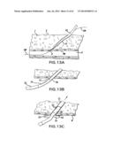 ARTICULATING SUTURING DEVICE AND METHOD diagram and image