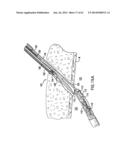 ARTICULATING SUTURING DEVICE AND METHOD diagram and image