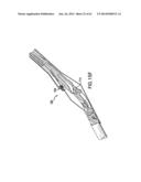 ARTICULATING SUTURING DEVICE AND METHOD diagram and image