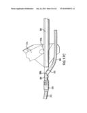 ARTICULATING SUTURING DEVICE AND METHOD diagram and image