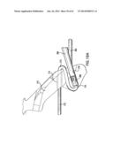 ARTICULATING SUTURING DEVICE AND METHOD diagram and image